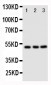 Anti-CXCR4 Antibody
